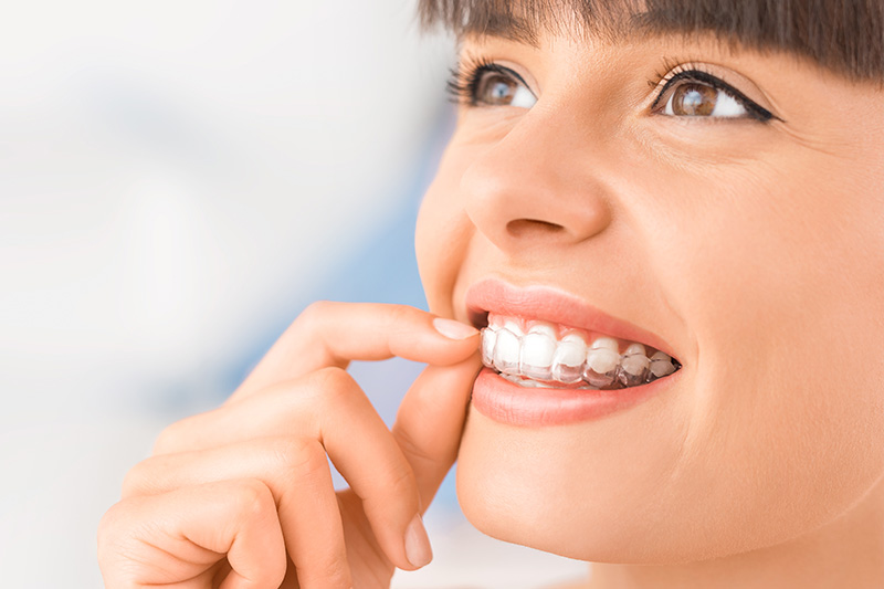 Invisalign in Hallandale Beach